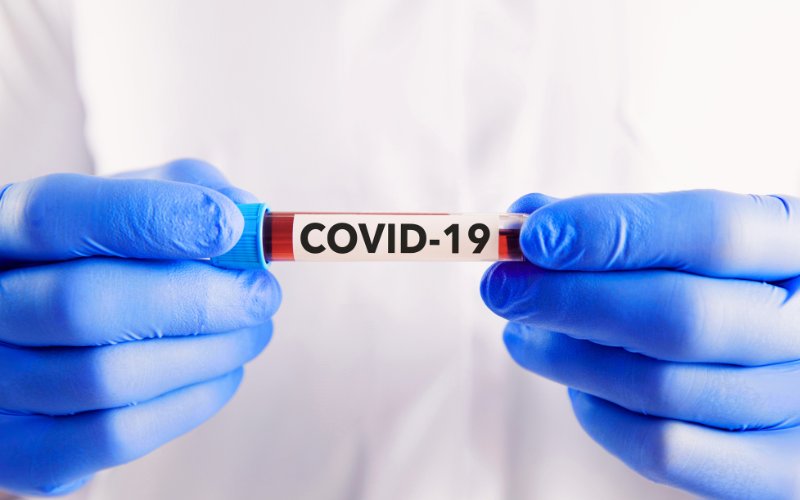 COVID-19 fingerprint test