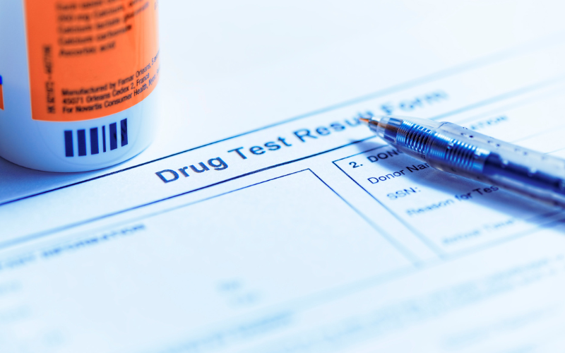 Understanding Workplace Drug Testing